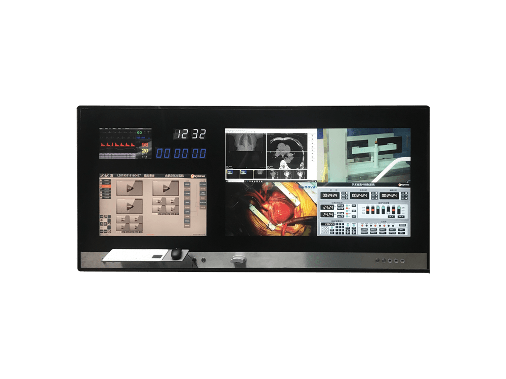 OR-CONSOLE multi-screen