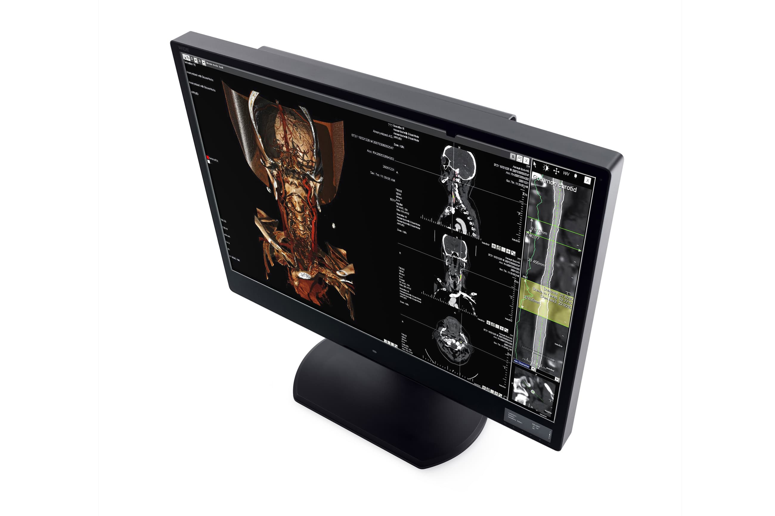 Diagnostické monitory