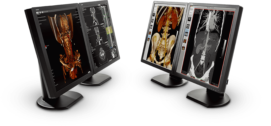 Diagnostické monitory